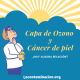 cáncer de piel y capa de ozono